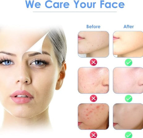 3-in-1 Ultrasonic Facial Skin Scrubber