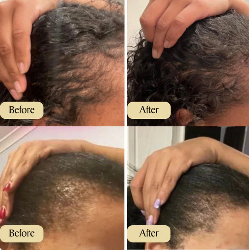 Hair Growth Oil - Natural Hair Thickening Treatment