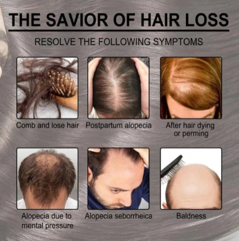 Rosemary Hair Care Essential Oil - Nourishing Hair Treatment