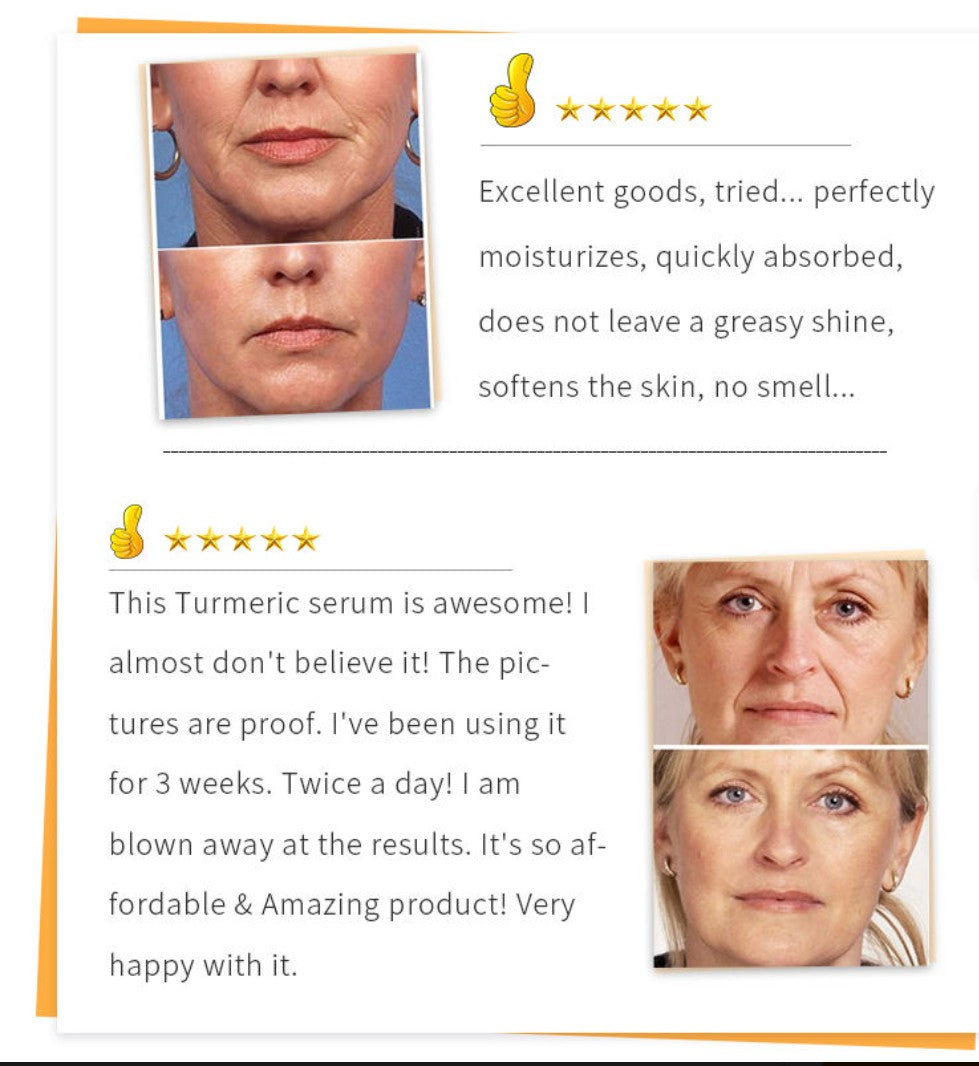 Beauty Lights Turmeric Serum