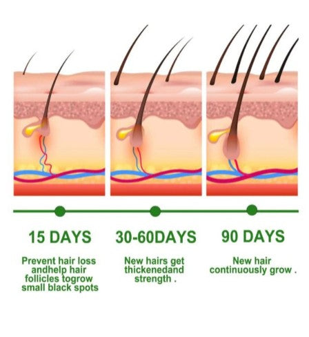 Rosemary Hair Care Essential Oil - Nourishing Hair Treatment